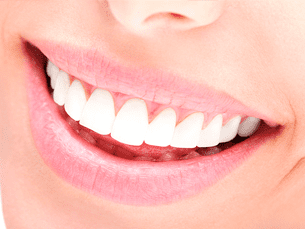 Clínica Dental Remei Gomà dentadura blanca